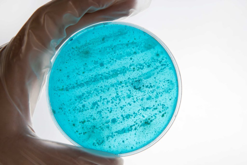 Mão com luva segura placa de cultura em análise de resistência antimicrobiana